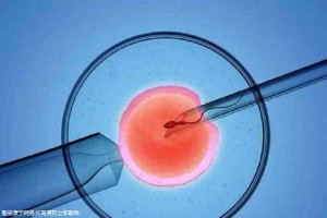 男性因素